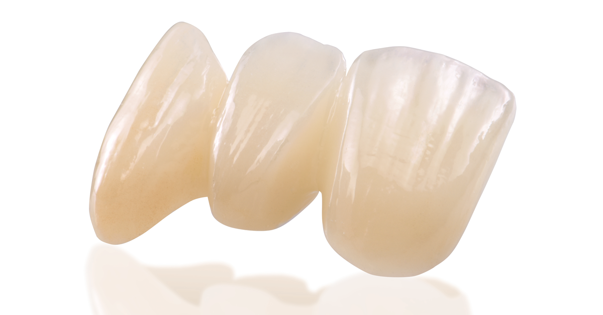 IPS e.max ZirCAD. Offers now even more possibilities