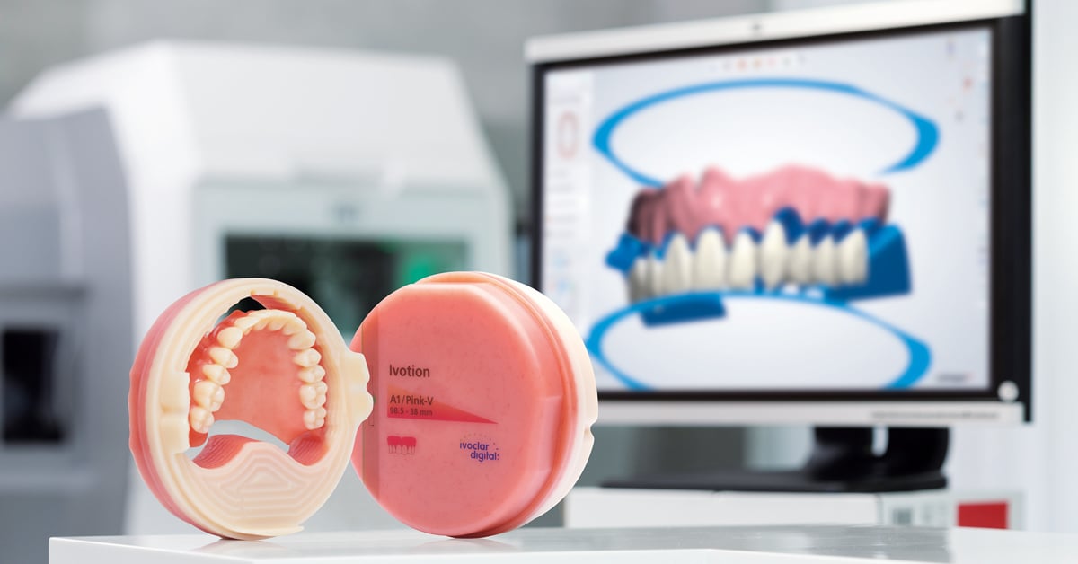 Ivotion Denture System revolutionizes the production of removable dentures
